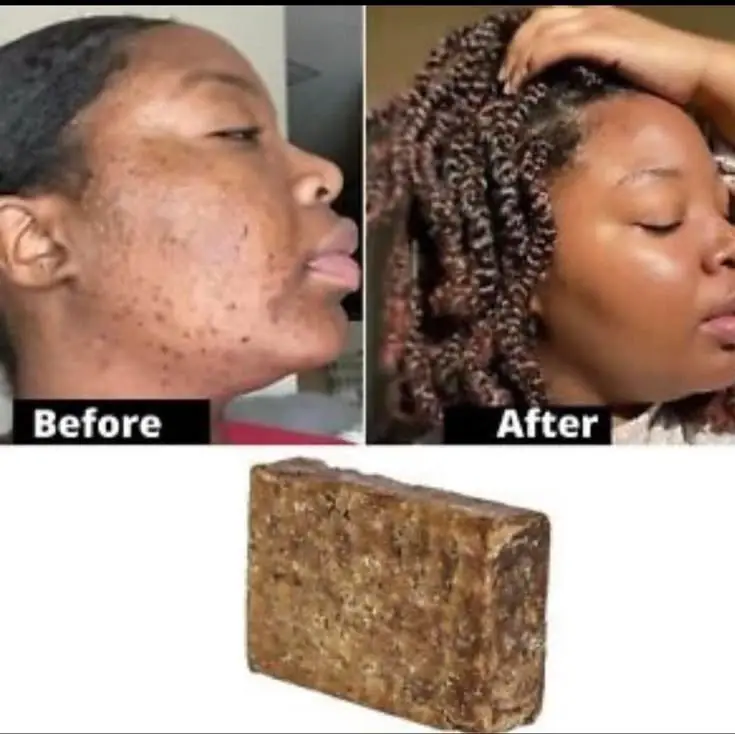 SALE. African black soap 🫧 isabune ikuraho ibiheri 💯